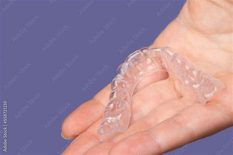 dental hygiene, orthodontic treatment, occlusal splint Stock Photo ...