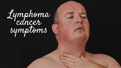 LYMPHOMA CANCER SYMPTOMS - YouTube
