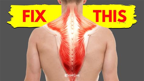 How to Fix a Tight Upper Back in 30 SECONDS | SpineCare