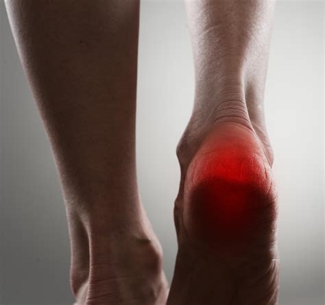 Heel Injuries | Heel Disorders | MedlinePlus