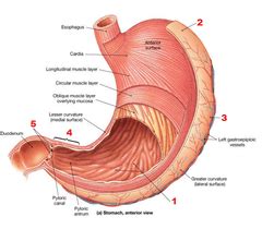 Don't lose your Pyloric Valve over a Failed Gastric Sleeve - DSSurgery