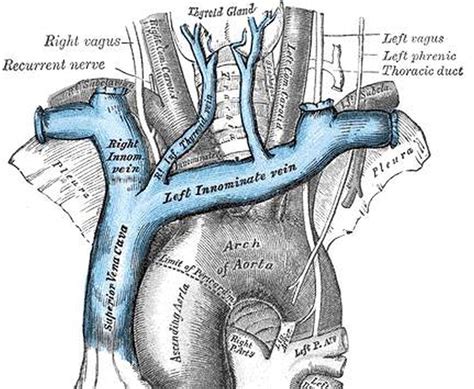 Pictures Of Brachiocephalic Vein(s)