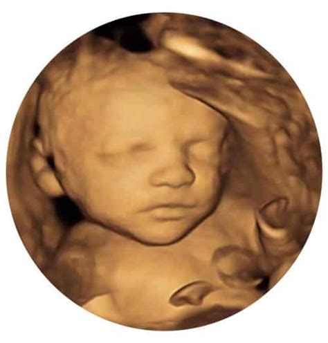 4D Scans + Well-being from Just £110 - Window to the Womb