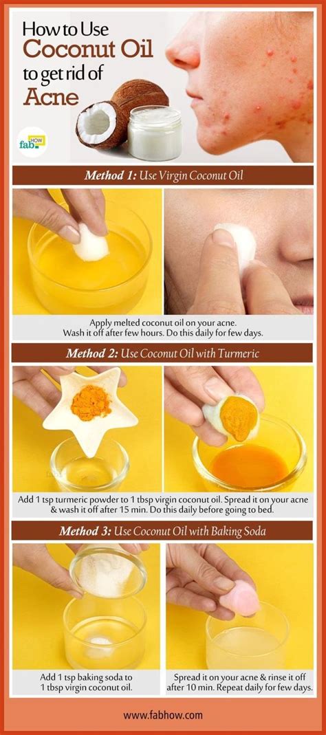 Homemade Acne Remedies - Alternative To Acne Care - At Home Acne Remedies >>> Check out this gre ...