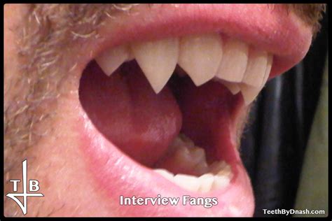 Interview | Teeth By Dnash