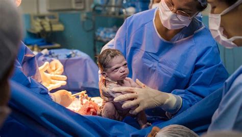 Photographer Captures Moment Newborn Baby Gives Doctors a 'Death Stare ...