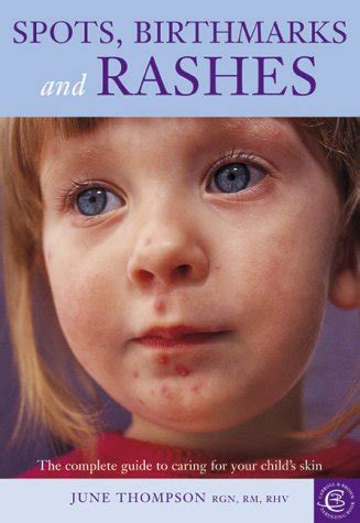 Spots, Birthmarks and Rashes: An Illustrated Guide to the ...