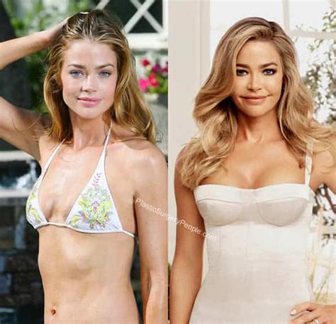 Denise Richards: BEFORE and AFTER 2019