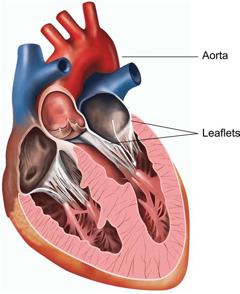 Mitral valve surgery | healthdirect