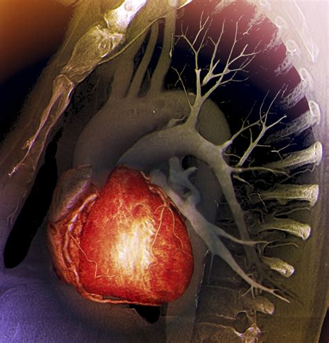 Mediastinal Lymphadenopathy: Reasons Why Your Lymph Nodes Are Enlarged ...