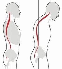 The Impact of Slouched Posture - CerviPedic Neck Relief