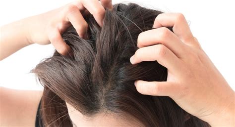 All You Need to Know about Sensitivity Scalp – Oasis Wellness Spa