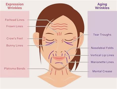 Bunny Lines Botox | Wrinkles Beside The Nose | Dr Majid Shah