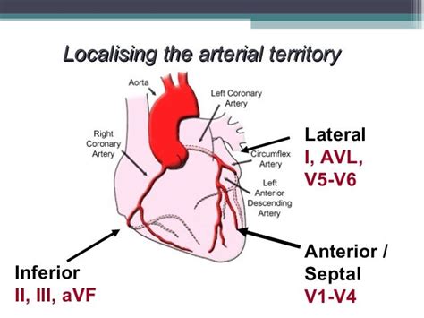 Ecg for beginners