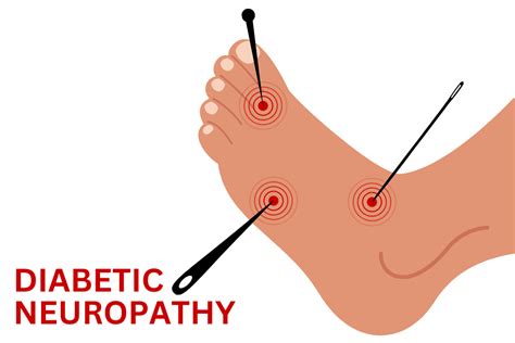 Understanding Neuropathy: Causes, Symptoms, and Treatments — COMFORTWIZ