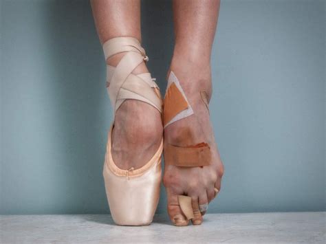 A ballerina's feet : r/pics