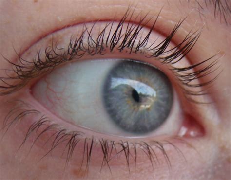 Central heterochromia vs hazel - gulucenter