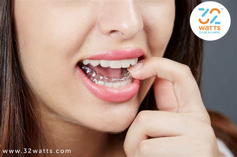 Invisible Braces Cost In Chennai, India | Best Clear Aligners Cost In Chennai