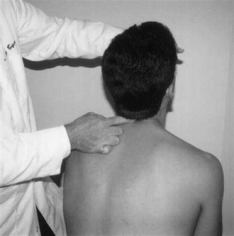 Cervical Orthopaedic Tests | Musculoskeletal Key