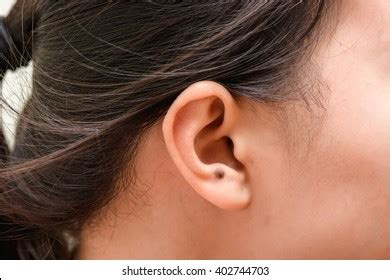 Birthmark On Ear Stock Photo 402744703 | Shutterstock