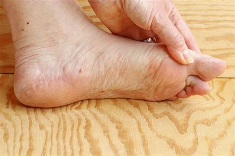 Call today for your appointment - River Podiatry I The Best Foot and ...