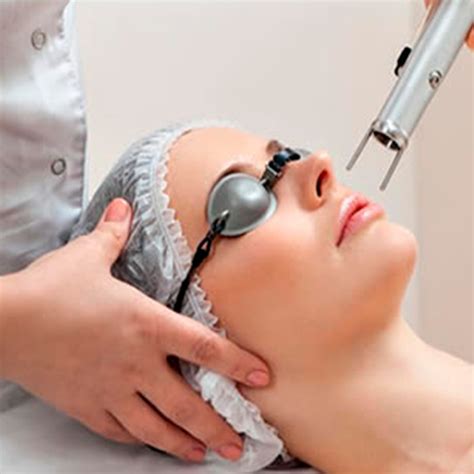 Q-Switch Laser - Cosmetic Laser & Skin Clinic