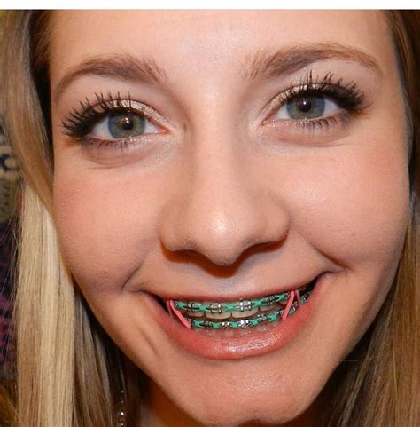 Pin by Sydni on Bikinis | Braces colors, Braces smile, Cute braces colors