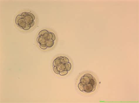 Vitrification & Frozen Embryo Transfer | Corion Fertility Clinic