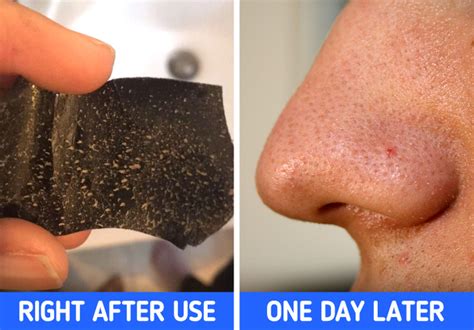 6 Things You Need to Know Before Using Pore Strips / Bright Side