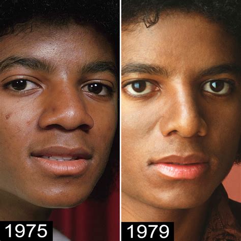 Michael Jackson Nose Before And After