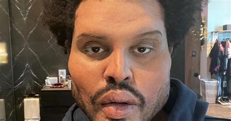 The Weeknd’s 'plastic surgery' mystery as fans hint it's a savage swipe ...