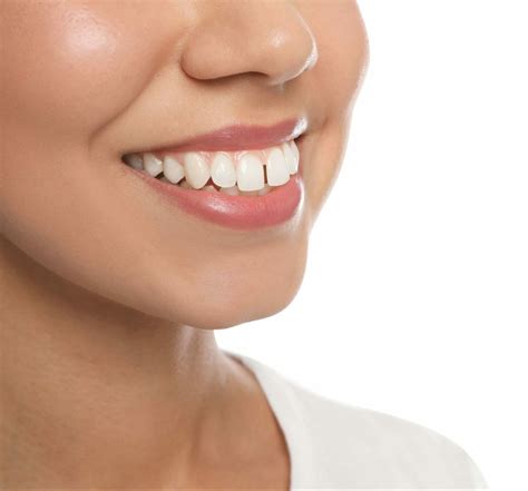 5 Ways to Fix a Gap Between Front Teeth