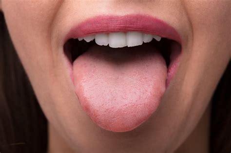 Dentist | How and Why You Should Clean Your Tongue | Dr. Jacob Milner