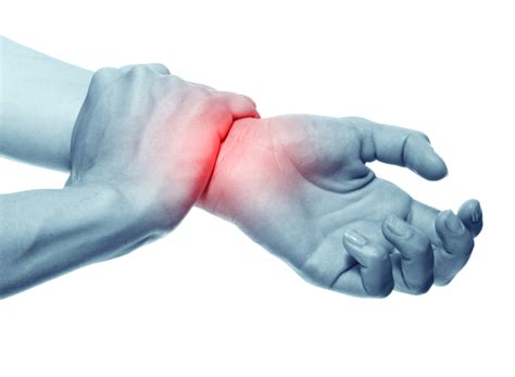 Wrist Sprain vs. Broken Wrist | Southeast Orthopedic Specialists