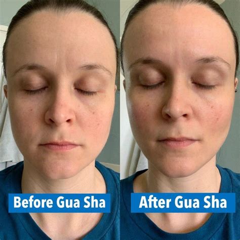 Gua Sha: Before and After Pics! | CelebrityStyleGuide