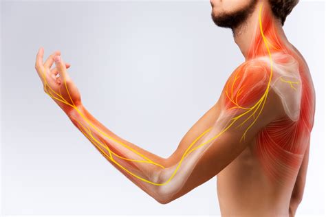 Shoulder, Arm and Hand Pain Treatment | Rotator Cuff Injury | Tennis Elbow | Weston Medical ...