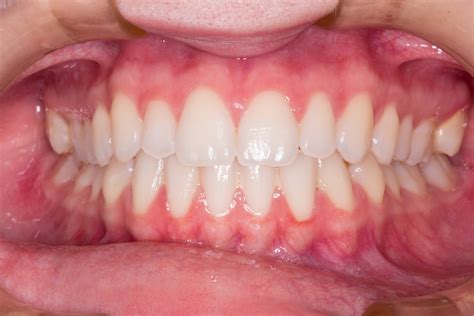 Types Of Teeth And Their Functions Worksheet