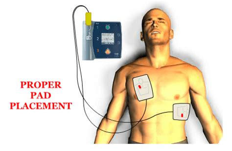 Online CPR - Adult AED