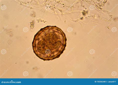 Ascaris Lumbricoides Royalty-Free Stock Photography | CartoonDealer.com #93433211