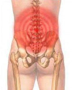 How To Banish Coccyx Pain... Massage Therapy Techniques, Lower Back Pain Exercises, Sciatica ...
