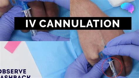 Intravenous (IV) cannulation | OSCE Guide | UKMLA | CPSA - YouTube