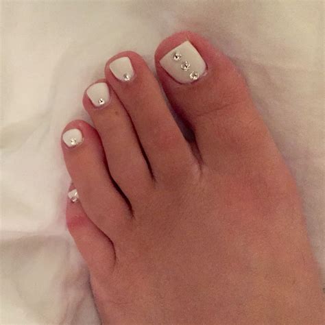 Top 96+ Images White Marks On Toenails Pictures Excellent