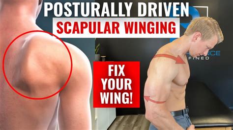 How to Fix Scapular Winging - YouTube