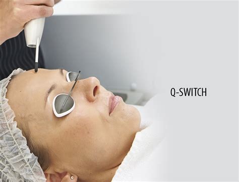 Q Switch Laser For Face