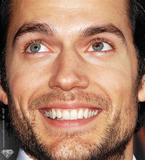 Actor Henry Cavill has sectoral heterochromia in his left eye. It is ...