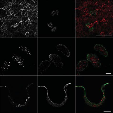 Analysis of differentiation of HaCaT cells in 2D and 3D models. HaCaT ...