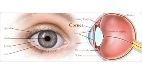 What is Cornea of Eye | Cornea Specialist Dr.Kareeshma Wadia | keratitis