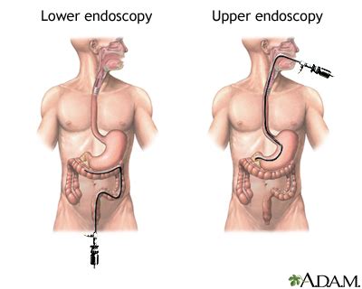 Lower Endoscopy Procedure