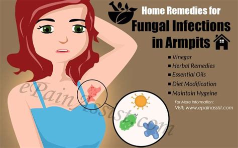 Home Remedies for Fungal Infections in Armpits | Fungal infection, Remedies, Home remedies