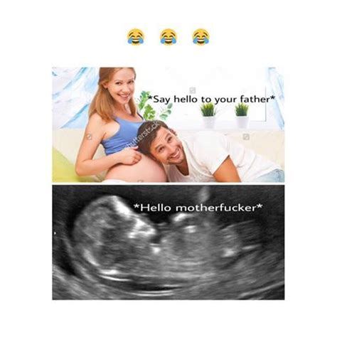 LITERAL FETUS!!! XD | You are the father, Funny pictures, Say hello